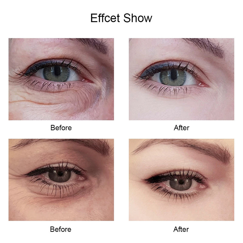 Moisturizing Eye Cream Improves Dark Circles